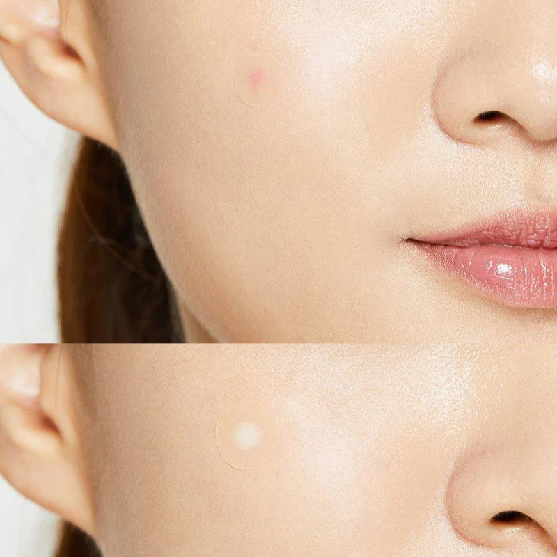 COSRX -  Acne Pimple Master Patch (24 Patchs) - Image 4